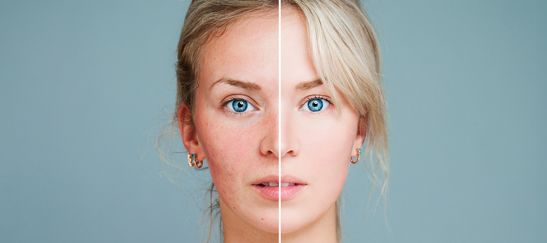 Rostro de mujer que muestra la diferencia entre claro 