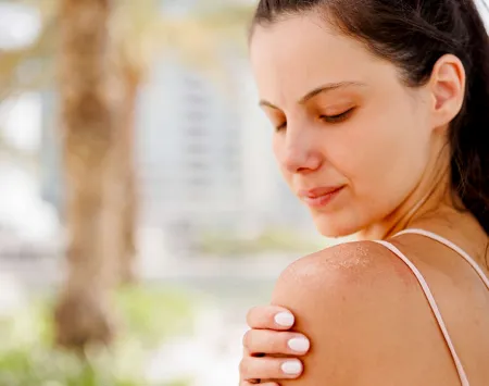 Hombro de una mujer, expuesta al sol